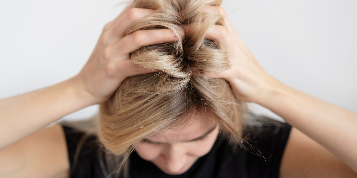 Comment éviter les démangeaisons avec une perruque ?